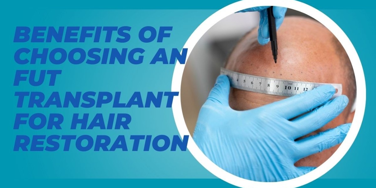 Benefits of Choosing an FUT Transplant for Hair Restoration