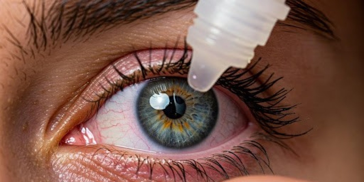 Prednisolone Eye Drops After LASIK