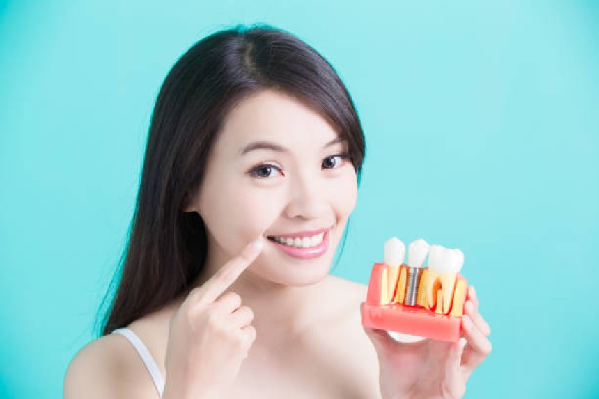 Blogs - Bang Box online - How Dental Implants Can Change Your Smile and Self-Confidence