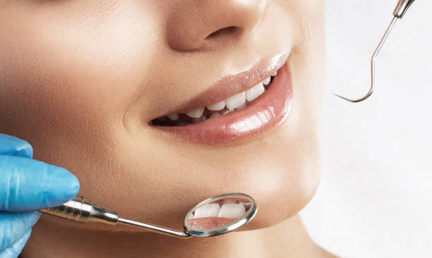 5 Stunning Benefits of Teeth Reshaping and Contouring | Longevity