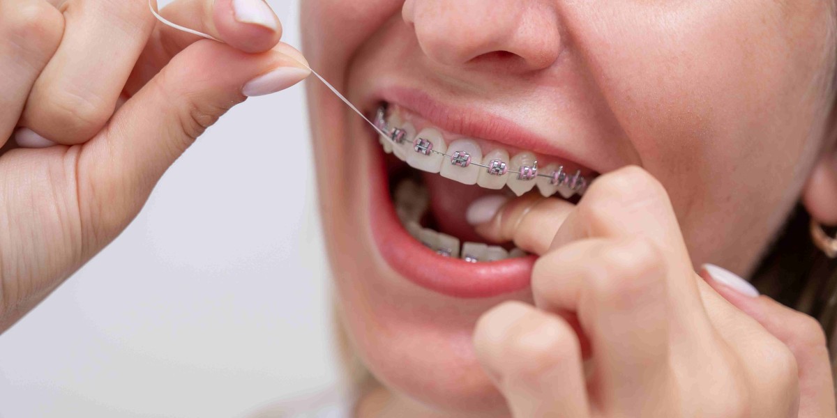 Gentle, Thoughtful Braces That Don’t Interrupt Life in Wolverhampton