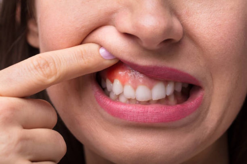 Blogs - Bang Box online - Understanding Gum Disease: Causes, Symptoms, and Treatment Options