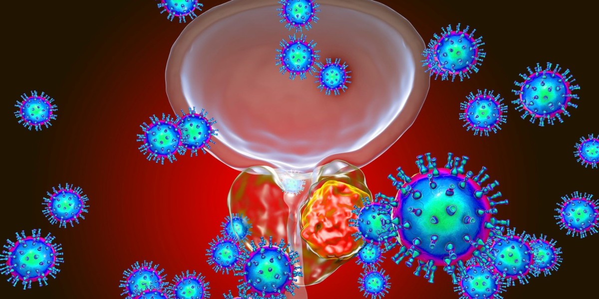 Europe Prostate Cancer Diagnostics Market to Reach USD 97.73 Billion by 2033: Growing Screening Awareness and Technologi