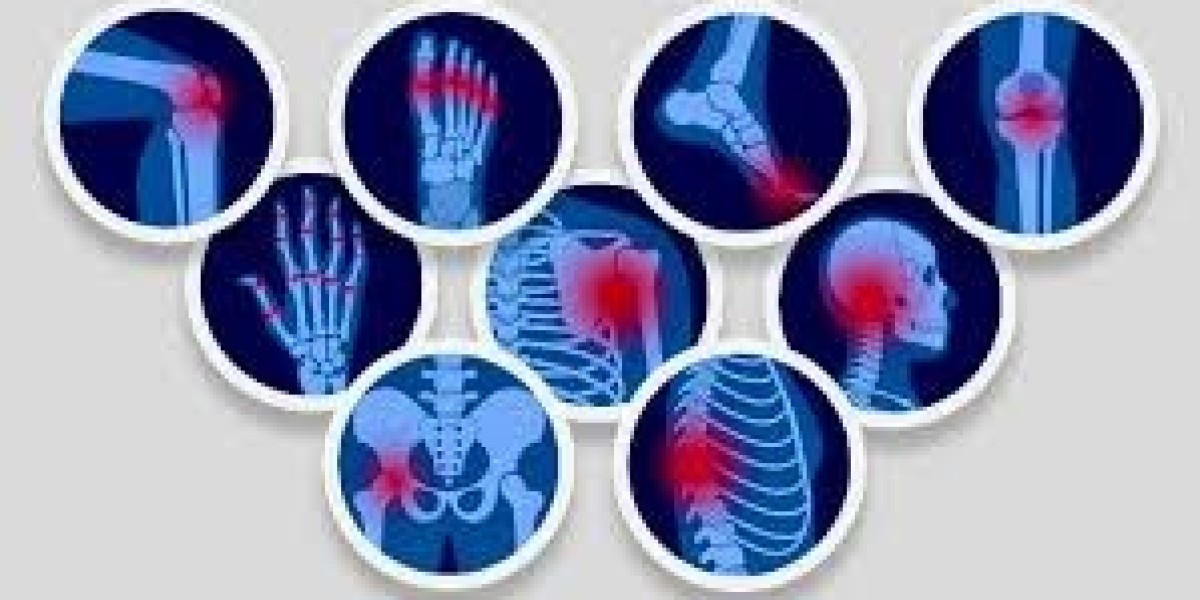 Managing Chronic Pain with Celebrex