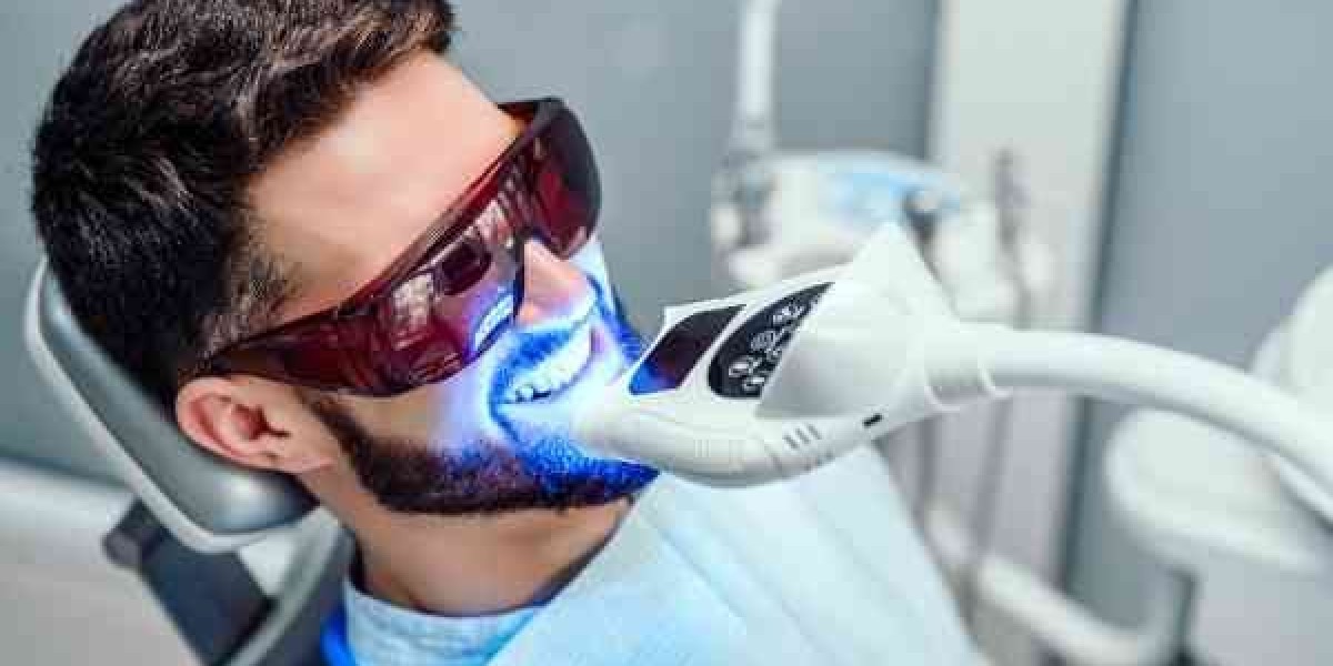 Teeth Whitening: At-Home Kits vs. Professional Treatment