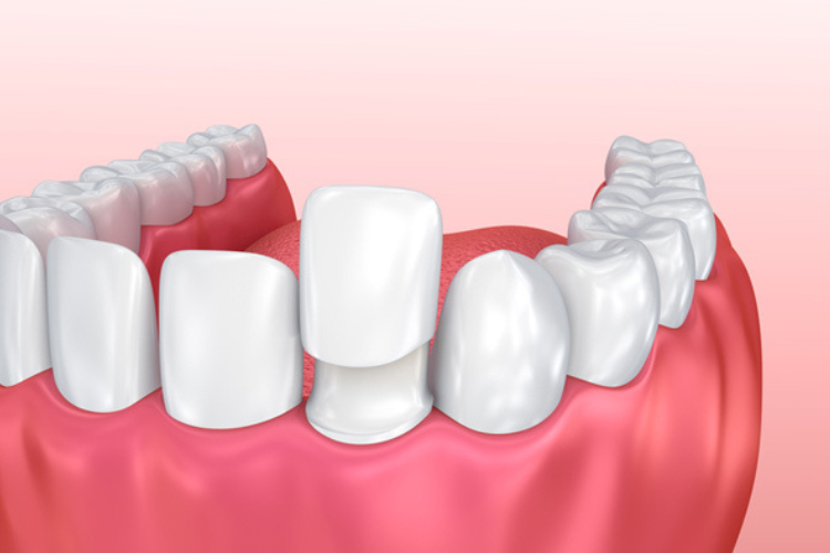 Cosmetic Dentistry