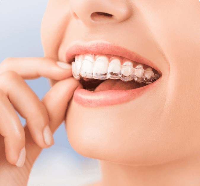 Redefine Your Look with Expert Cosmetic Dentistry in Dubai