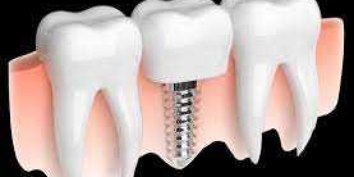 laser gum surgery near me