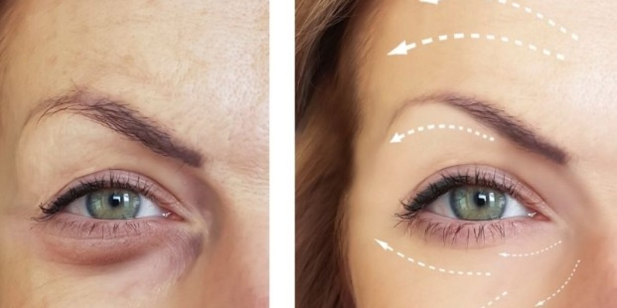 Dermal Fillers and HydraFacial in Mississauga: A Real Look at Why Everyone’s Talking About Them