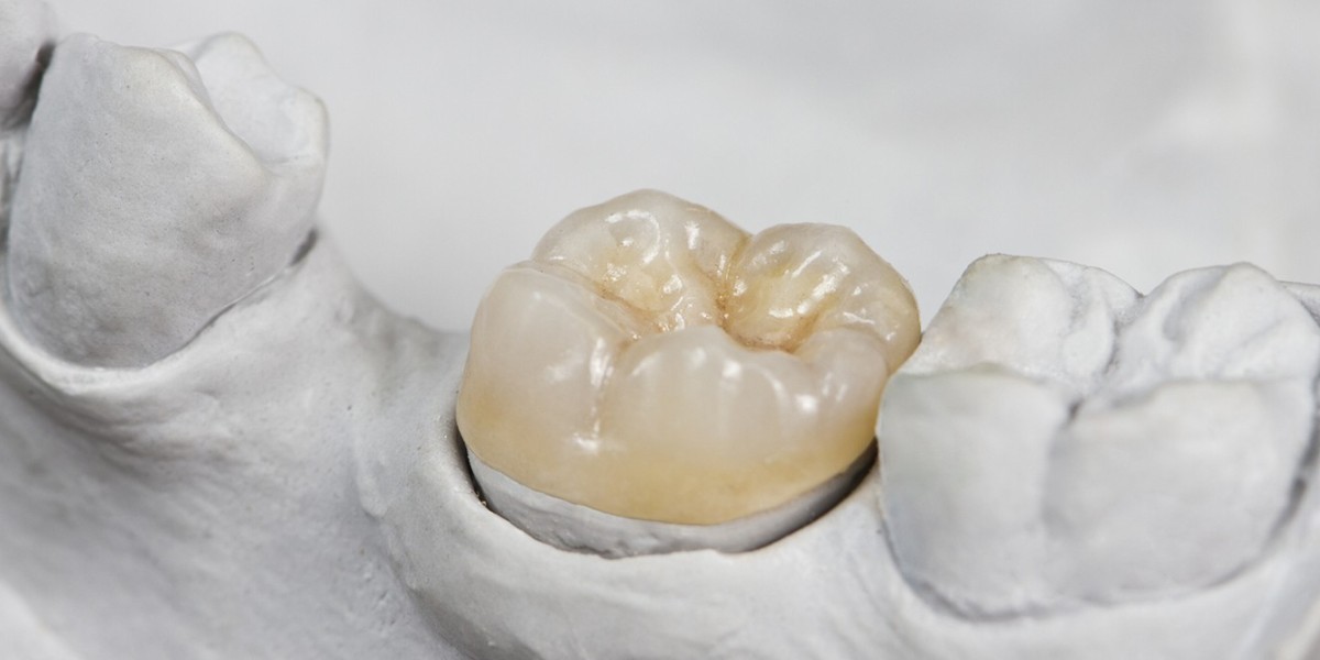 Restoring Strength & Beauty to Your Teeth